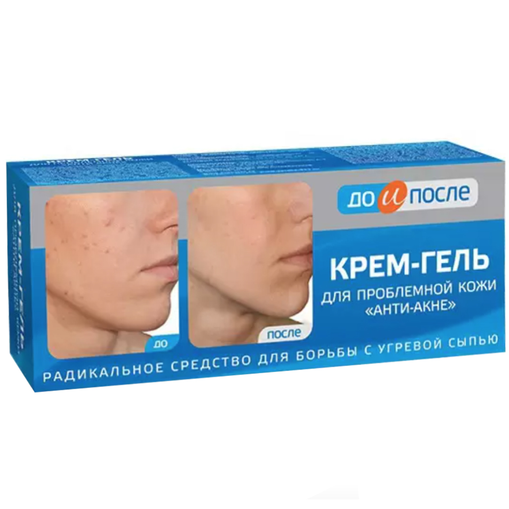 Anti-Acne Cream-Gel for Problem Skin 
